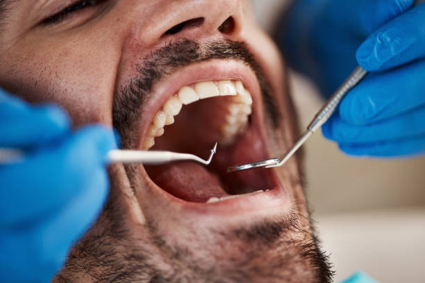 Best Tooth Pain Emergency Relief  in Washburn, IL