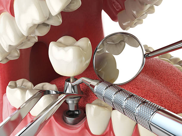 Best Urgent Dental Care  in Washburn, IL